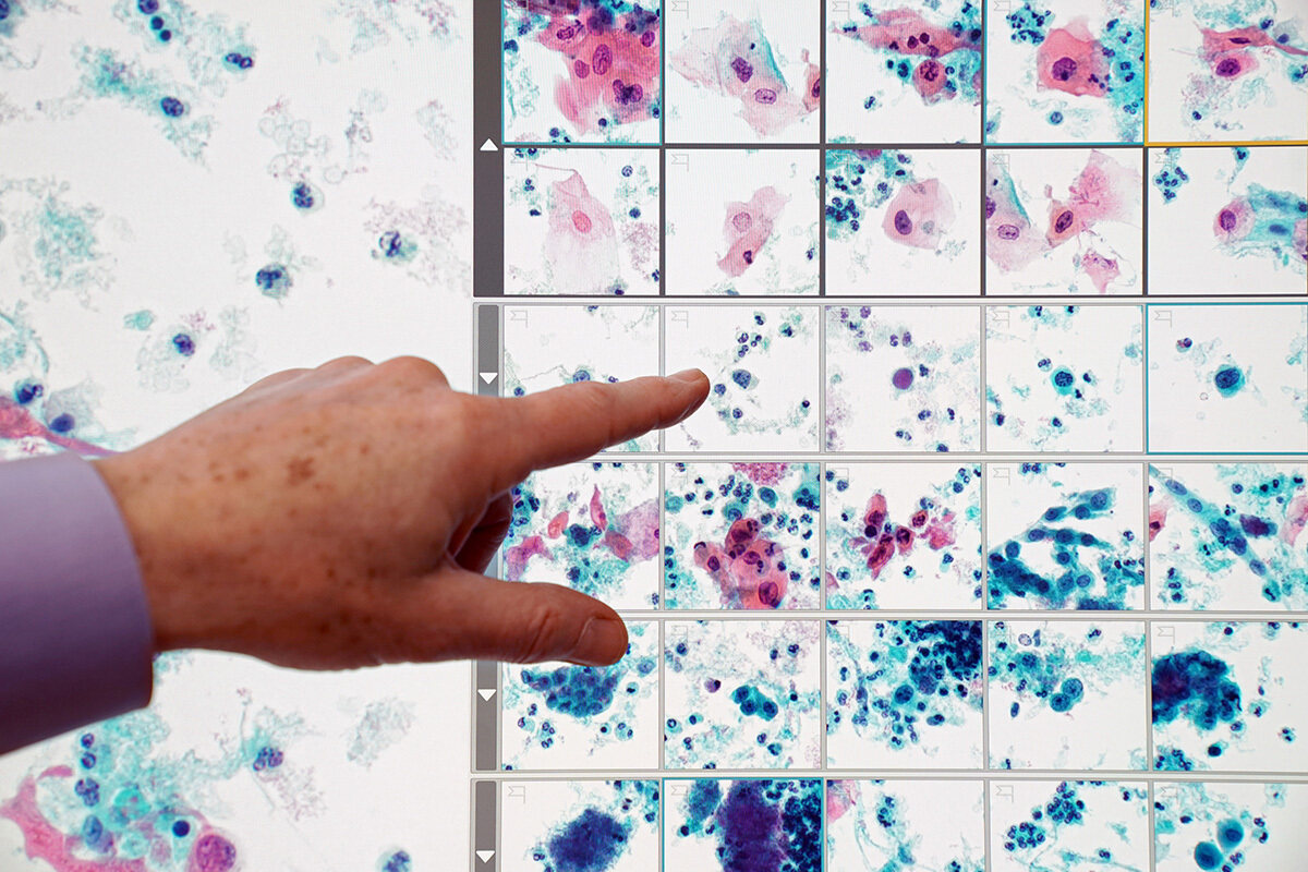 27 Fakty O Cytologia